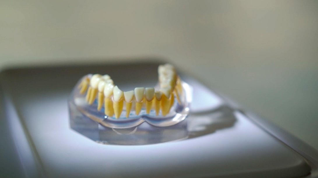 Wie viele Zähne hat ein Mensch?