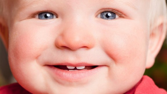 Zahnersatz für Kinder Baby mit Milchzähnen