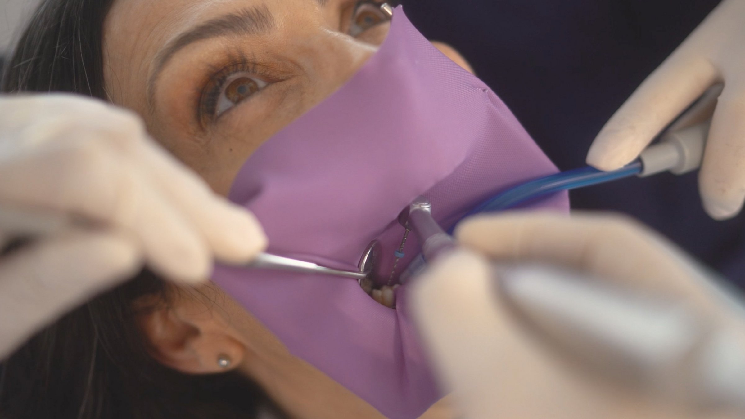 Was ist ein Stiftzahn?