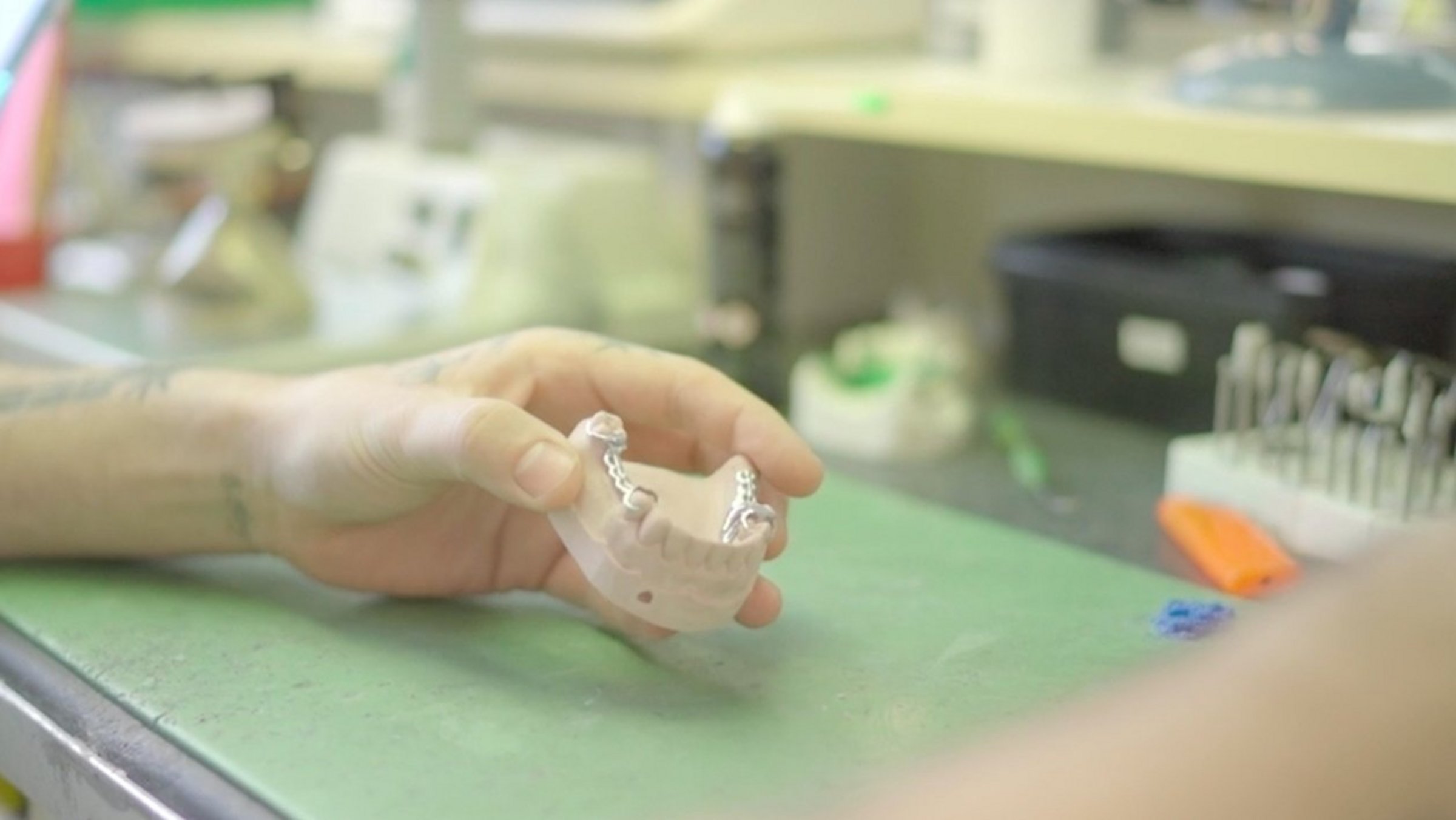 Zahnersatz aus dem Dentallabor