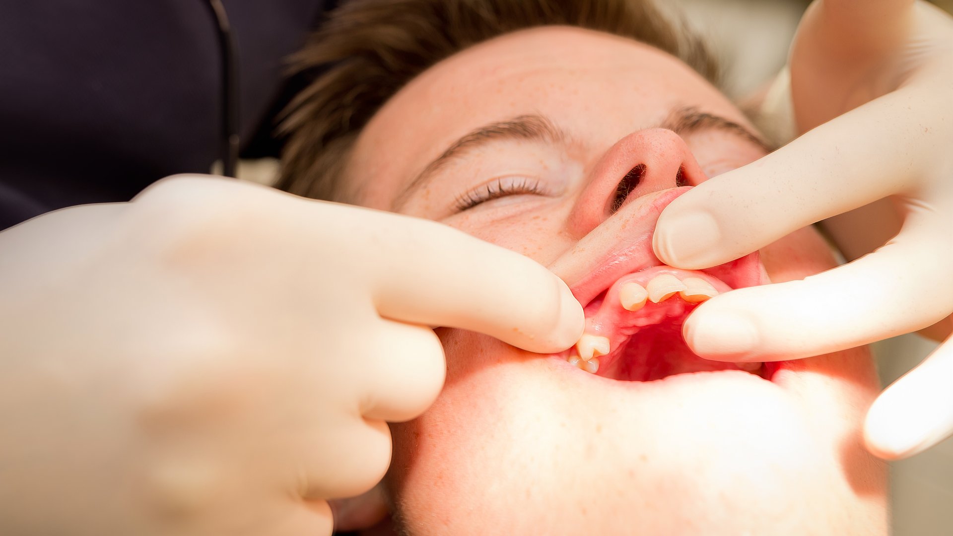 Leichte Sprache Zähne