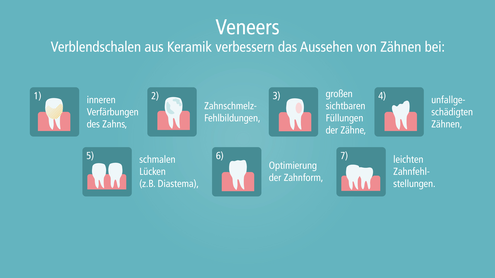 Veneers Zähne
